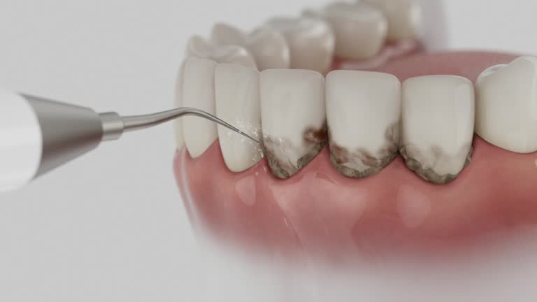 Trusted Wisdom Tooth Removal service in Santa Rosa Valley, CA - Dentist Open Now
